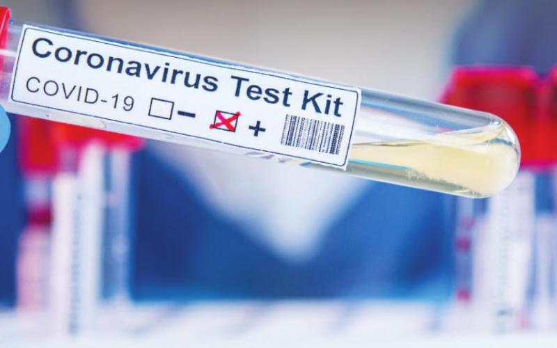 Statewide Count Hits 65,053 Cases of Covid-19