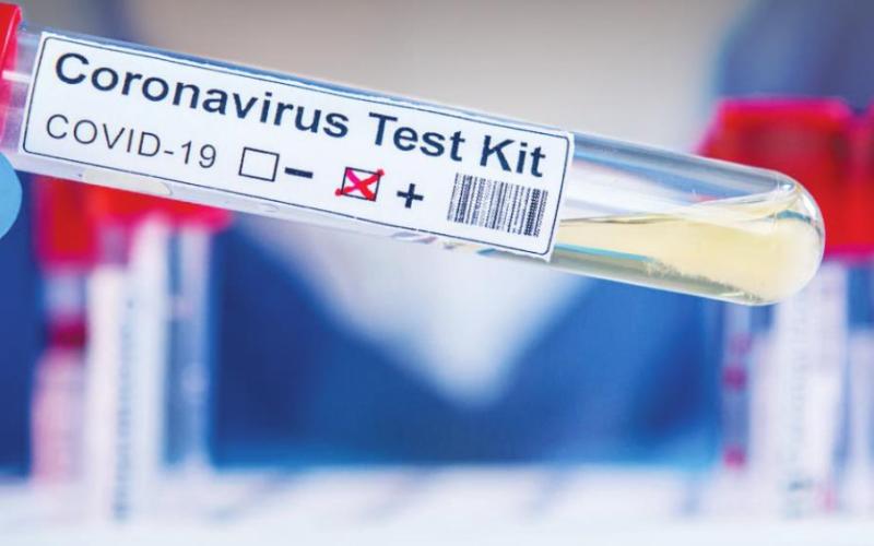 Oklahoma Sees 59,399 Total Covid-19 Cases Statewide