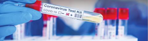 Statewide Count Hits 65,053 Cases of Covid-19