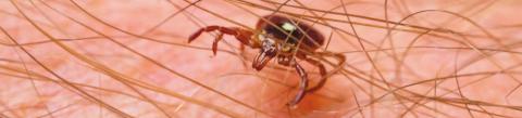 How to Treat a Tick Bite and When to See a Doctor